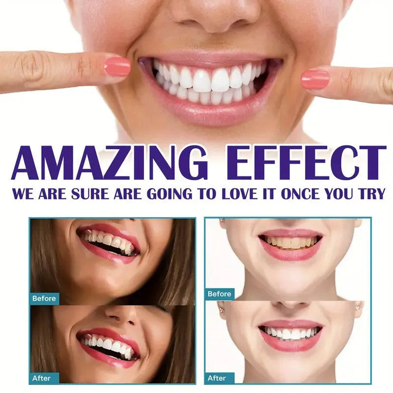 TEETH WHITENING PEN